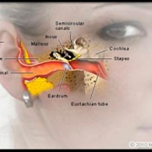 Ear Buzzing - I Stumbled Upon An Ear Ringing Treatment That May Perhaps Alleviate Tinnitus